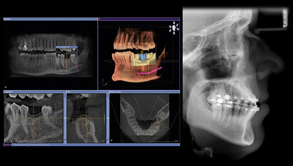 three dimensional x-ray imaging